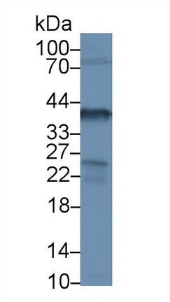 Polyclonal Antibody to Nucleophosmin 1 (NPM1)