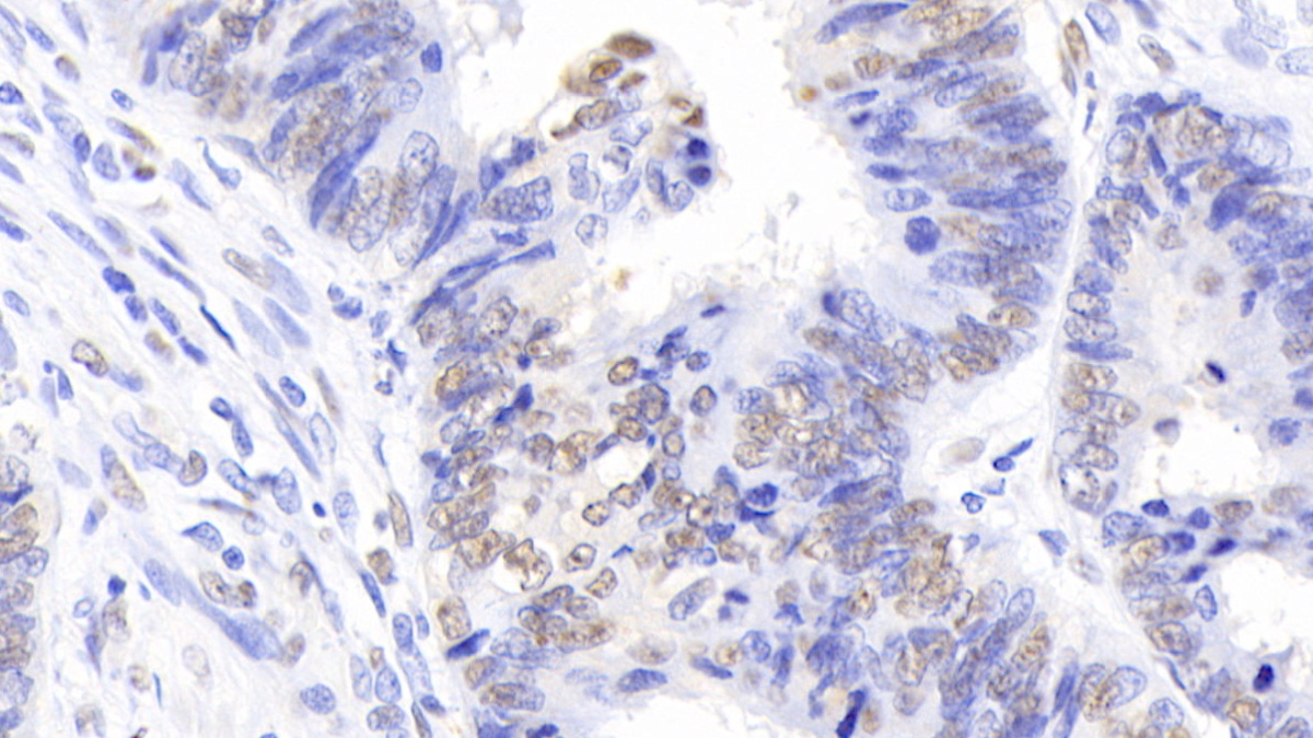 Polyclonal Antibody to Nucleophosmin 1 (NPM1)