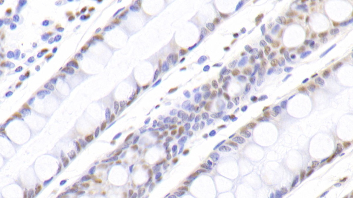 Polyclonal Antibody to Nucleophosmin 1 (NPM1)