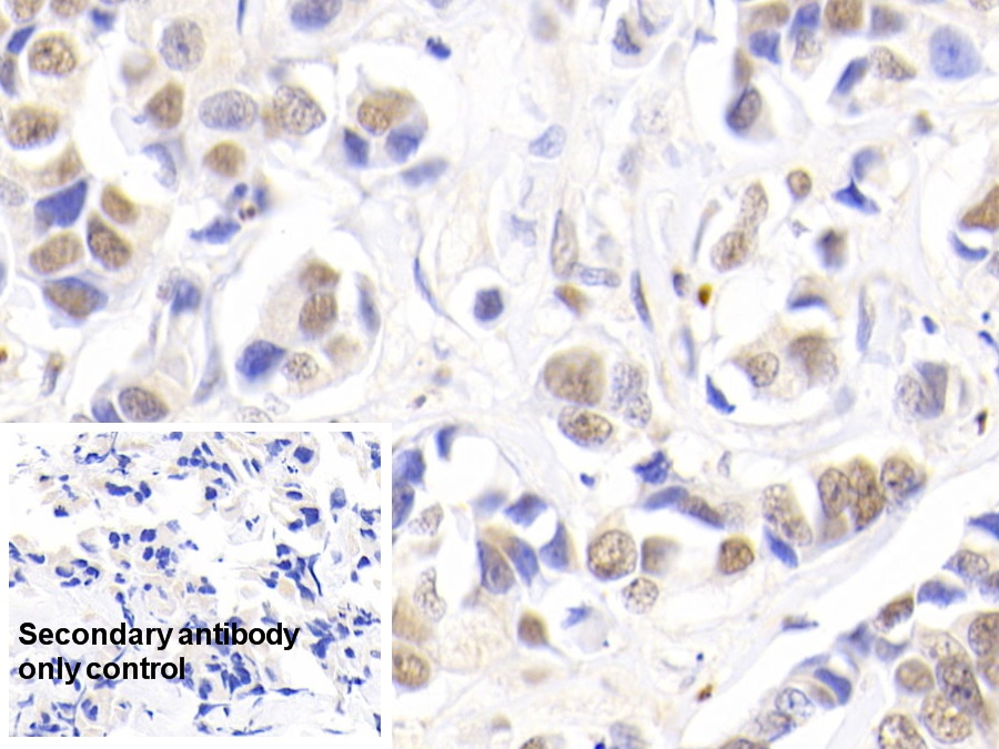 Polyclonal Antibody to Nucleophosmin 1 (NPM1)