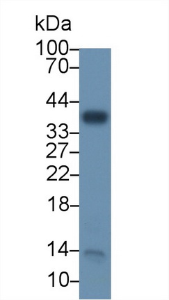 Polyclonal Antibody to Nucleophosmin 1 (NPM1)