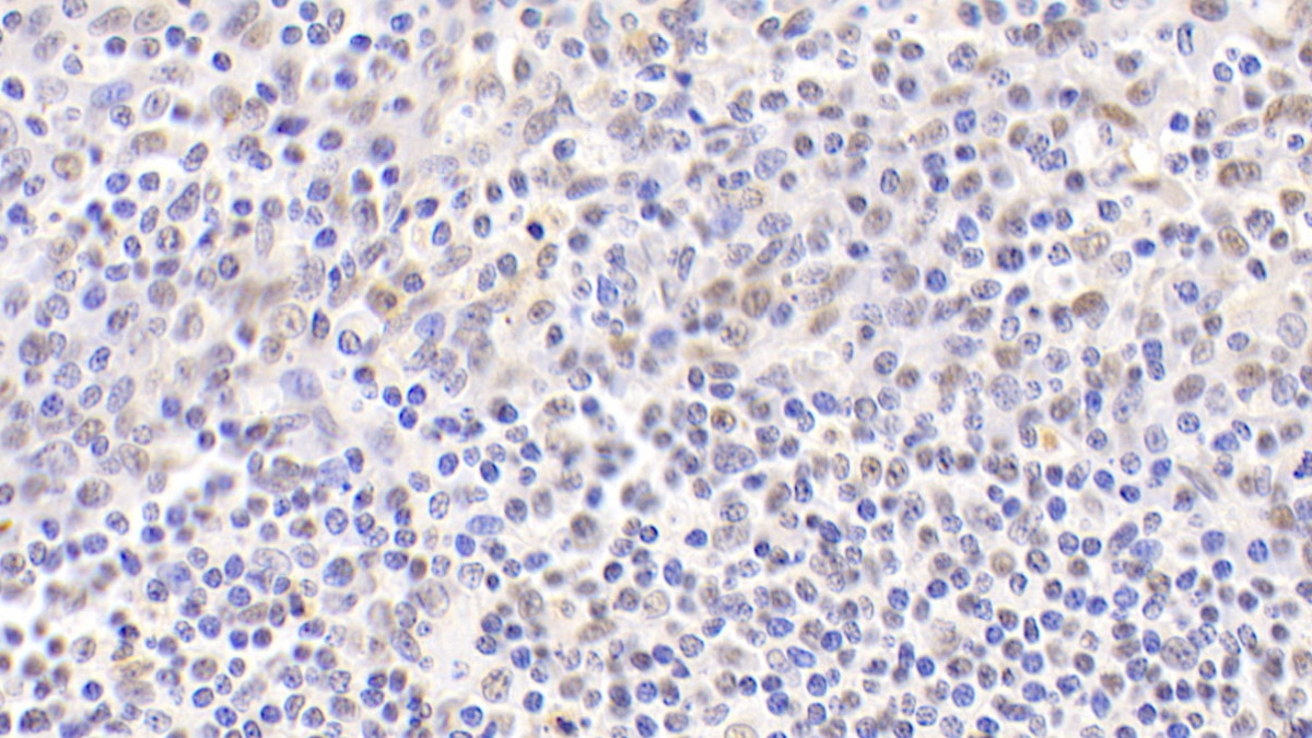 Polyclonal Antibody to Nucleophosmin 1 (NPM1)