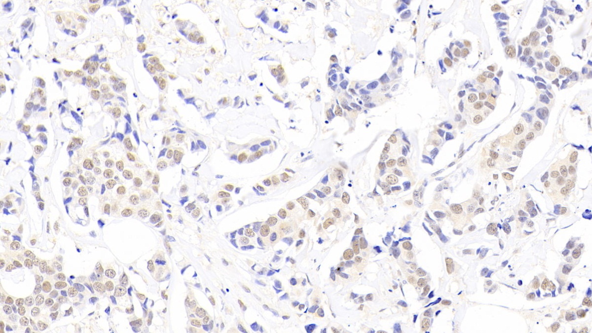 Polyclonal Antibody to Nucleophosmin 1 (NPM1)