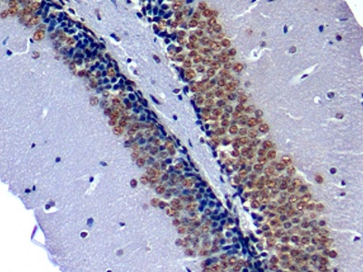 Polyclonal Antibody to Nucleophosmin 1 (NPM1)