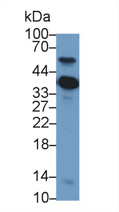 Polyclonal Antibody to Nucleophosmin 1 (NPM1)