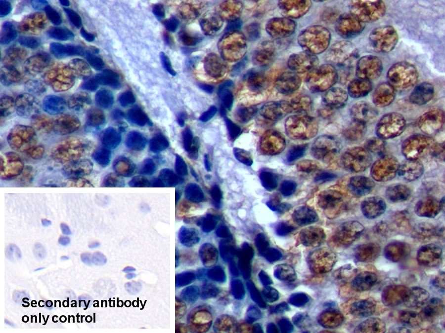 Polyclonal Antibody to Nucleophosmin 1 (NPM1)