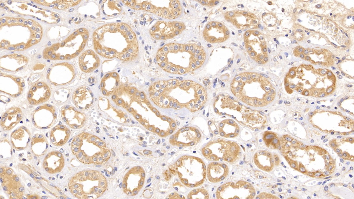 Polyclonal Antibody to Optic Atrophy 3 (OPA3)