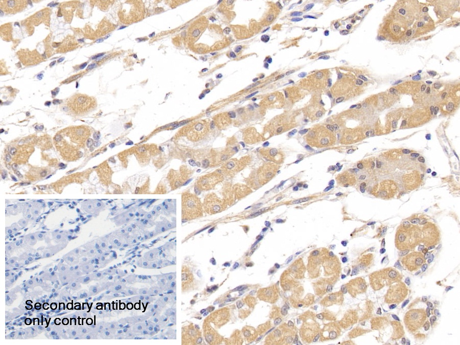 Polyclonal Antibody to Optic Atrophy 3 (OPA3)