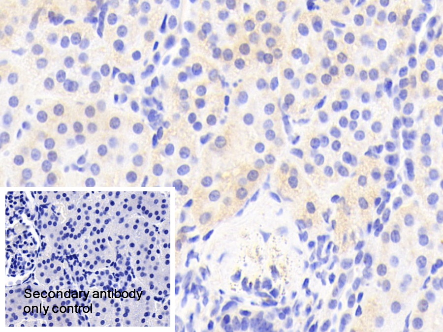 Polyclonal Antibody to Optic Atrophy 3 (OPA3)