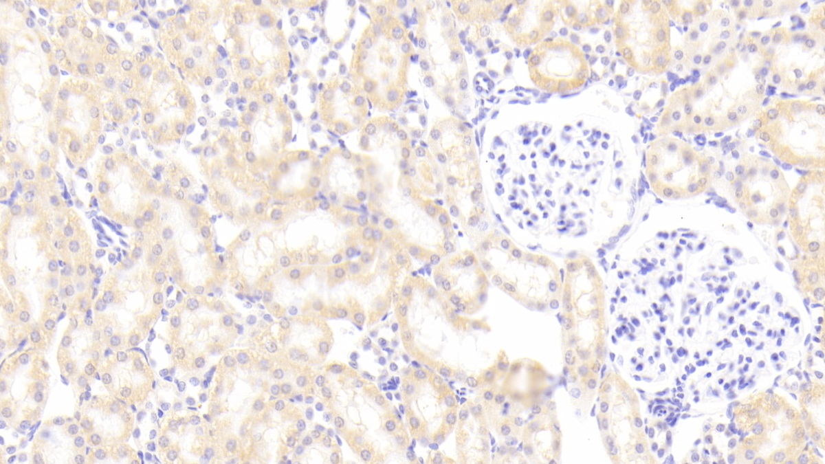 Polyclonal Antibody to Phospholipid Transfer Protein (PLTP)