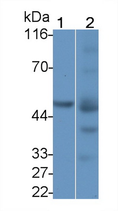 Polyclonal Antibody to Phospholipid Transfer Protein (PLTP)