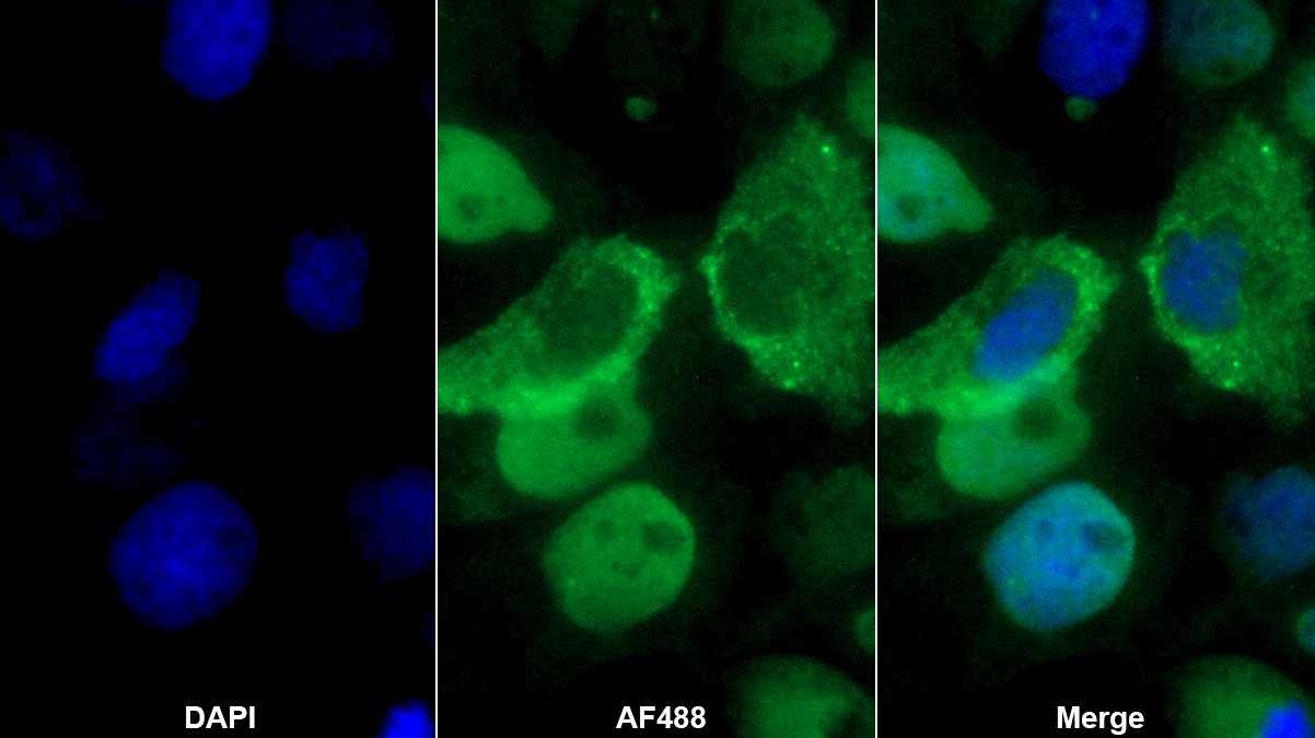 Polyclonal Antibody to Polypyrimidine Tract Binding Protein 1 (PTBP1)