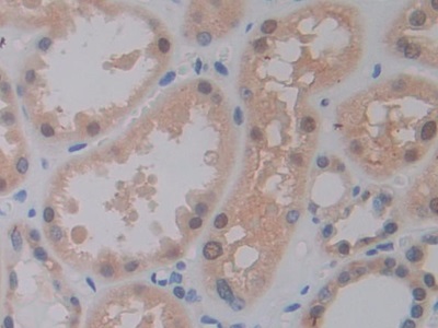 Polyclonal Antibody to Pancreas Specific Transcription Factor 1a (PTF1a)