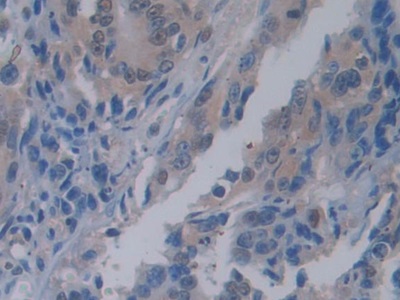 Polyclonal Antibody to Pancreas Specific Transcription Factor 1a (PTF1a)
