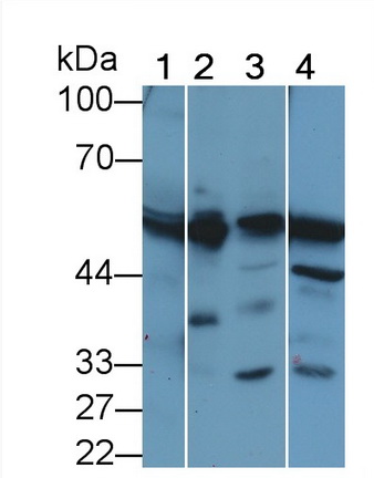 Polyclonal Antibody to Phenylalanine Hydroxylase (PAH)