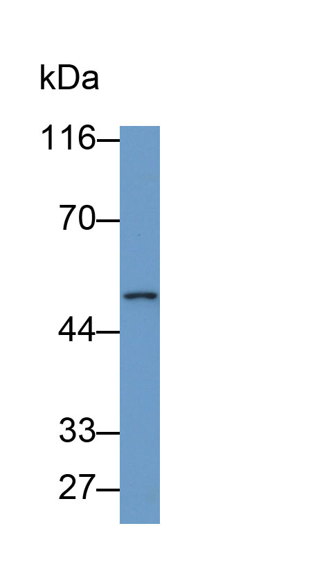 Polyclonal Antibody to Phenylalanine Hydroxylase (PAH)