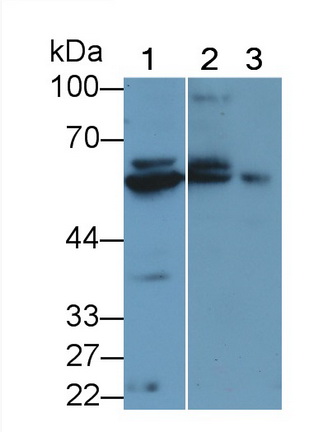 Polyclonal Antibody to Phenylalanine Hydroxylase (PAH)