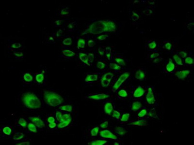 Polyclonal Antibody to Prosaposin (PSAP)