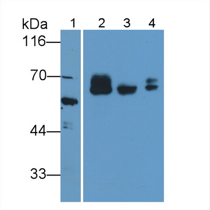 Polyclonal Antibody to Prosaposin (PSAP)