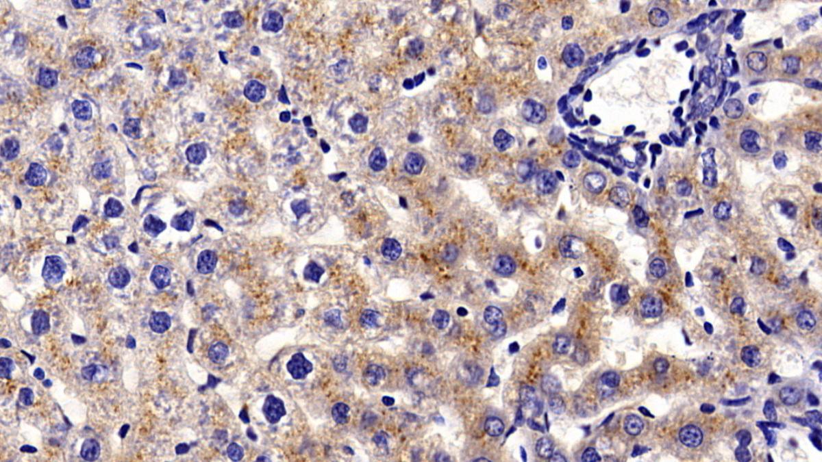 Polyclonal Antibody to Prosaposin (PSAP)