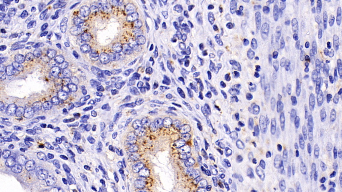 Polyclonal Antibody to Prosaposin (PSAP)