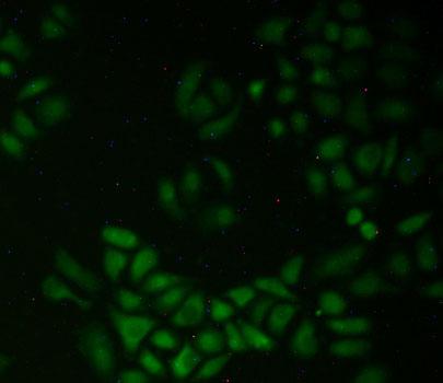 Polyclonal Antibody to Quiescin Q6 Sulfhydryl Oxidase 1 (QSOX1)