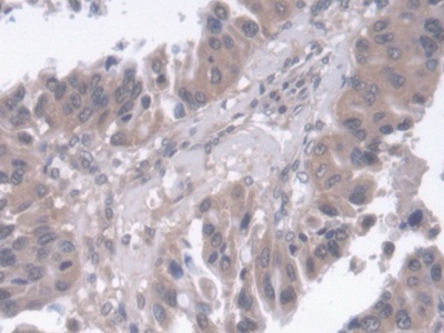 Polyclonal Antibody to Regucalcin (RGN)