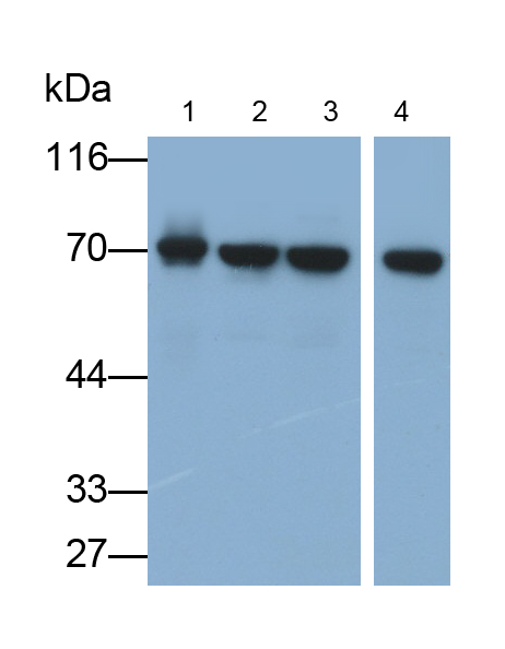 Polyclonal Antibody to Ribophorin I (RPN1)