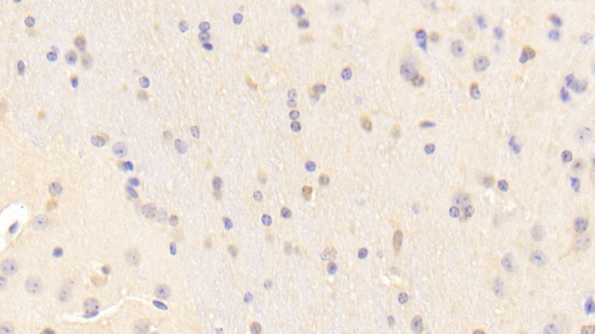 Polyclonal Antibody to Reelin (RELN)