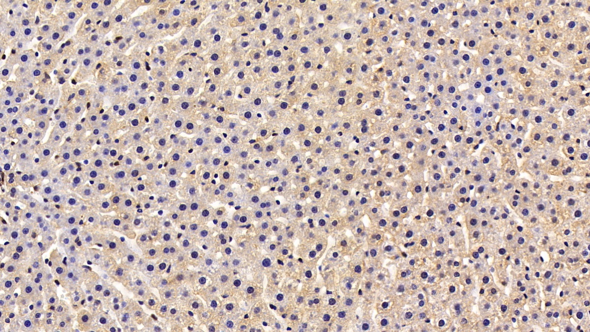 Polyclonal Antibody to Reelin (RELN)