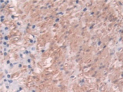 Polyclonal Antibody to Transgelin (TAGLN)