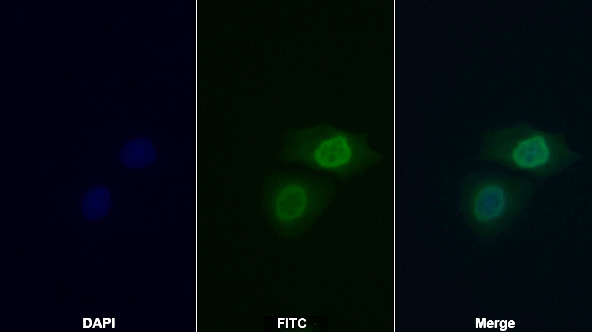 Polyclonal Antibody to Tyrosyl DNA Phosphodiesterase 1 (TDP1)