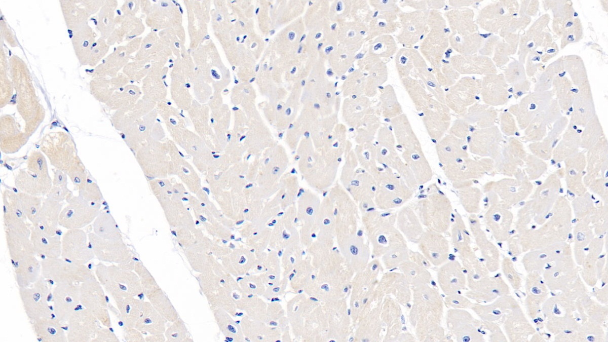 Polyclonal Antibody to Tuberous Sclerosis Protein 1 (TSC1)