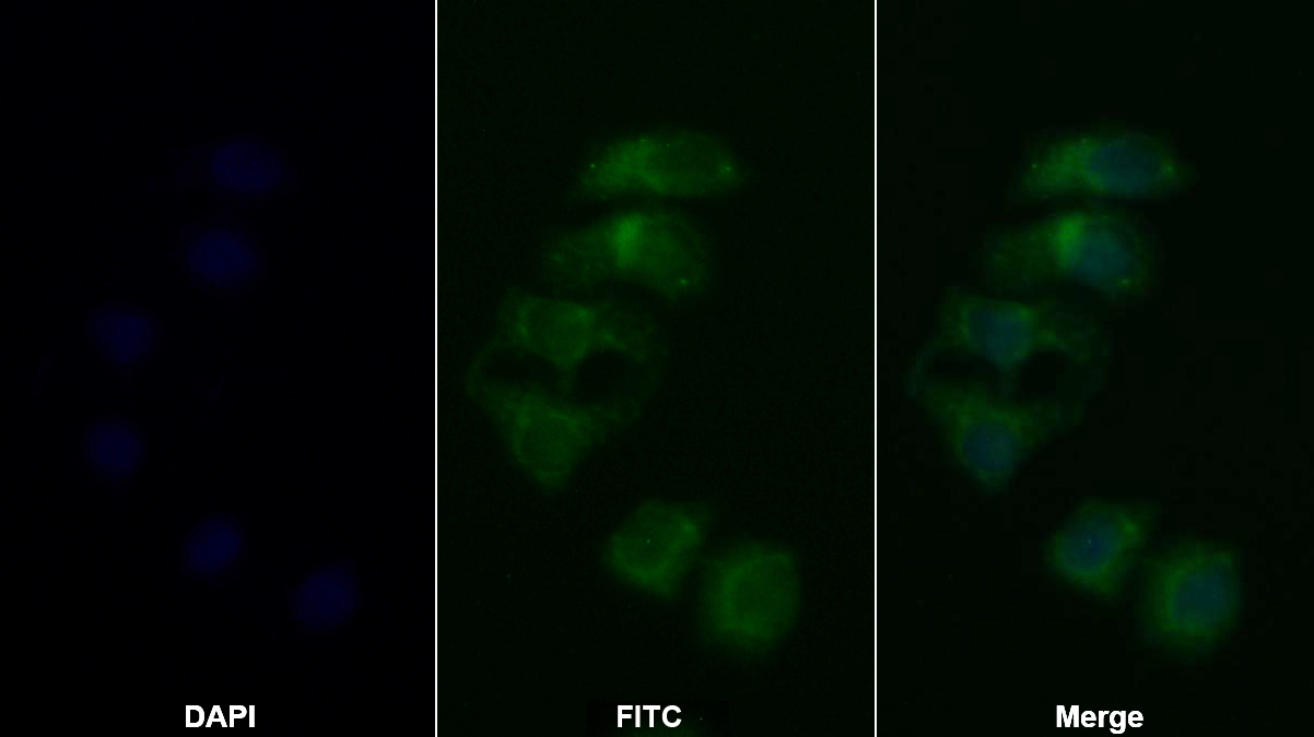 Polyclonal Antibody to Tuberous Sclerosis Protein 1 (TSC1)