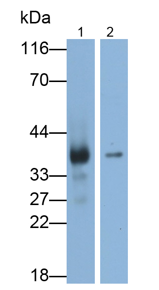 Polyclonal Antibody to Thiosulfate Sulfurtransferase (TST)