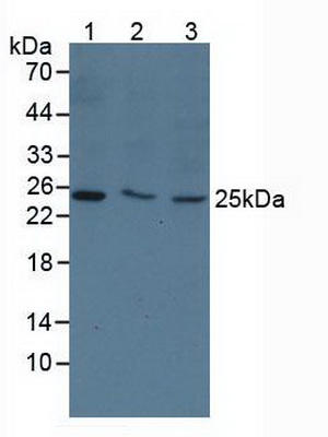 Polyclonal Antibody to Thymidine Kinase 1, Soluble (TK1)