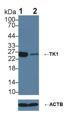 Polyclonal Antibody to Thymidine Kinase 1, Soluble (TK1)