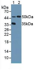 Polyclonal Antibody to Tripeptidyl Peptidase I (TPP1)