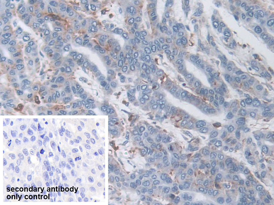 Polyclonal Antibody to Tripeptidyl Peptidase I (TPP1)