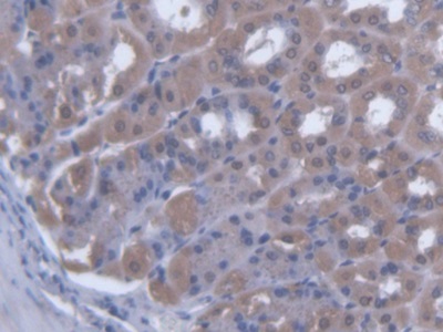 Polyclonal Antibody to Sciellin (SCEL)