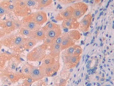 Polyclonal Antibody to Renalase (RNLS)