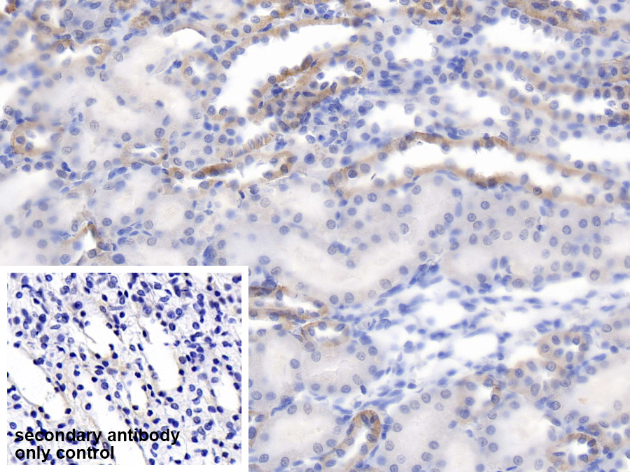 Polyclonal Antibody to Synuclein Alpha Interacting Protein 1 (SNCaIP1)