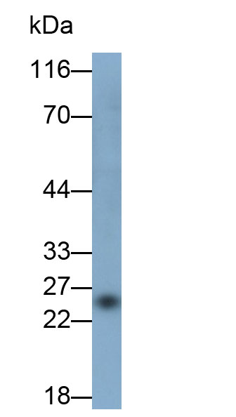 Polyclonal Antibody to Sclerostin (SOST)