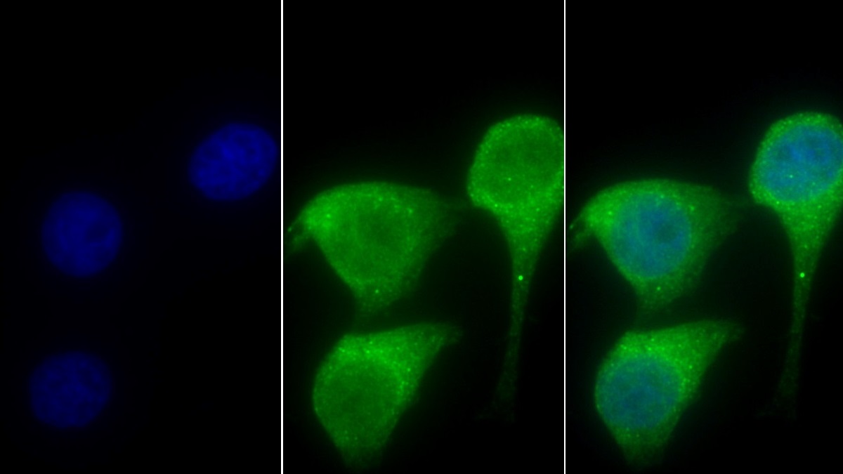 Polyclonal Antibody to Signal Recognition Particle Receptor B (SRPRB)