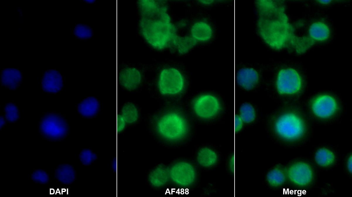 Polyclonal Antibody to Stathmin 1 (STMN1)