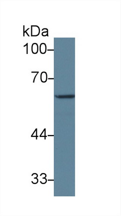 Polyclonal Antibody to Glutamate Decarboxylase 1, Brain (GAD1)