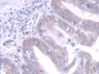 Polyclonal Antibody to Fibroblast Growth Factor 20 (FGF20)