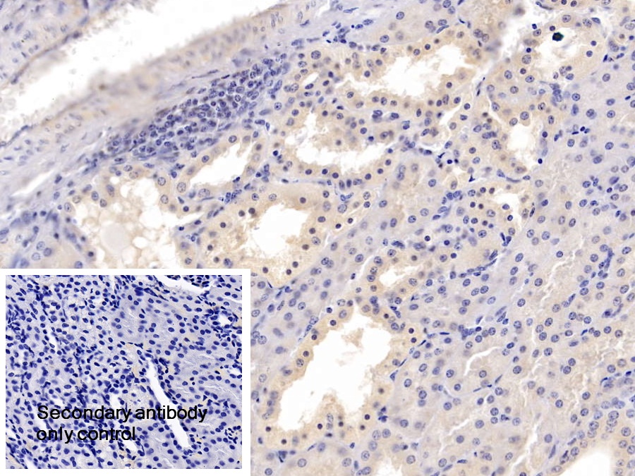 Polyclonal Antibody to Platelet Derived Growth Factor Subunit B (PDGFB)