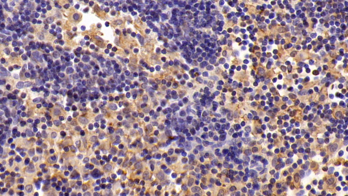 Polyclonal Antibody to Free Fatty Acid Receptor 2 (FFAR2)