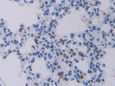 Polyclonal Antibody to Cathepsin C (CTSC)